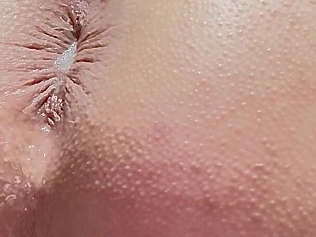 Loose Hole After Inflatable (Asshole therapy)