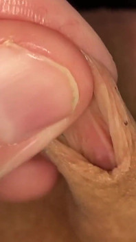 包皮玩小多汁的鸡巴