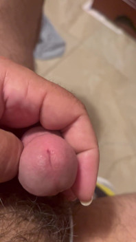 My Dick