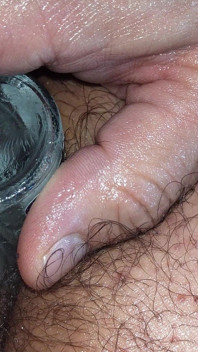Anal Masturbation