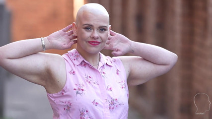 Euro Bald: Emily