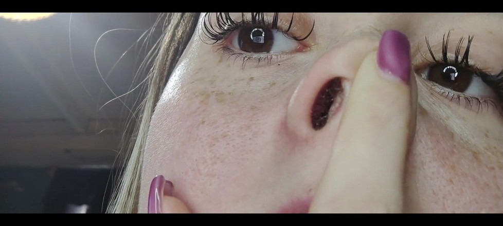 RavenHearth666VIP: Cận cảnh chảy nước mũi