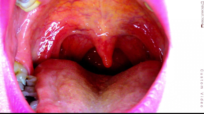 Scarlet Vixen: Sexy scarlet sagt Ahhhh - uvula zeigt
