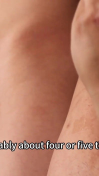 Thin Skin Milk I. Fire of the Desire. Ep.1
