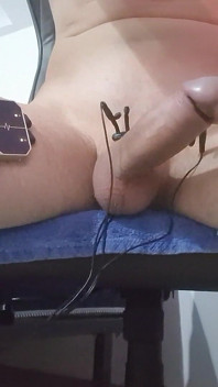 E-stim Hfo