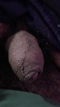 Telugu Abbayi Video