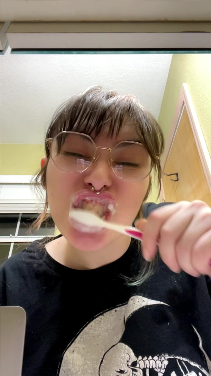 Mushroombitchx: Berus gigi saya