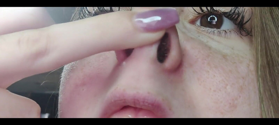 RavenHearth666VIP: Runny Nose Close up