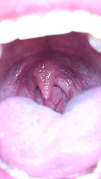 Fetiche de lengua