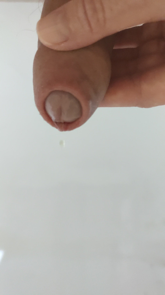 Peanuts_69: Đi tiểu thư giãn
