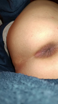 My Anus