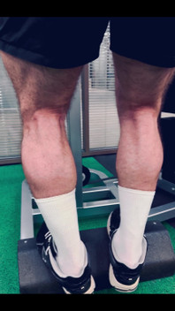 My Legs