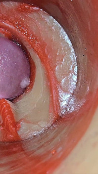 Inseminação feminina - câmera interna captura ejaculação enorme do macho profundo