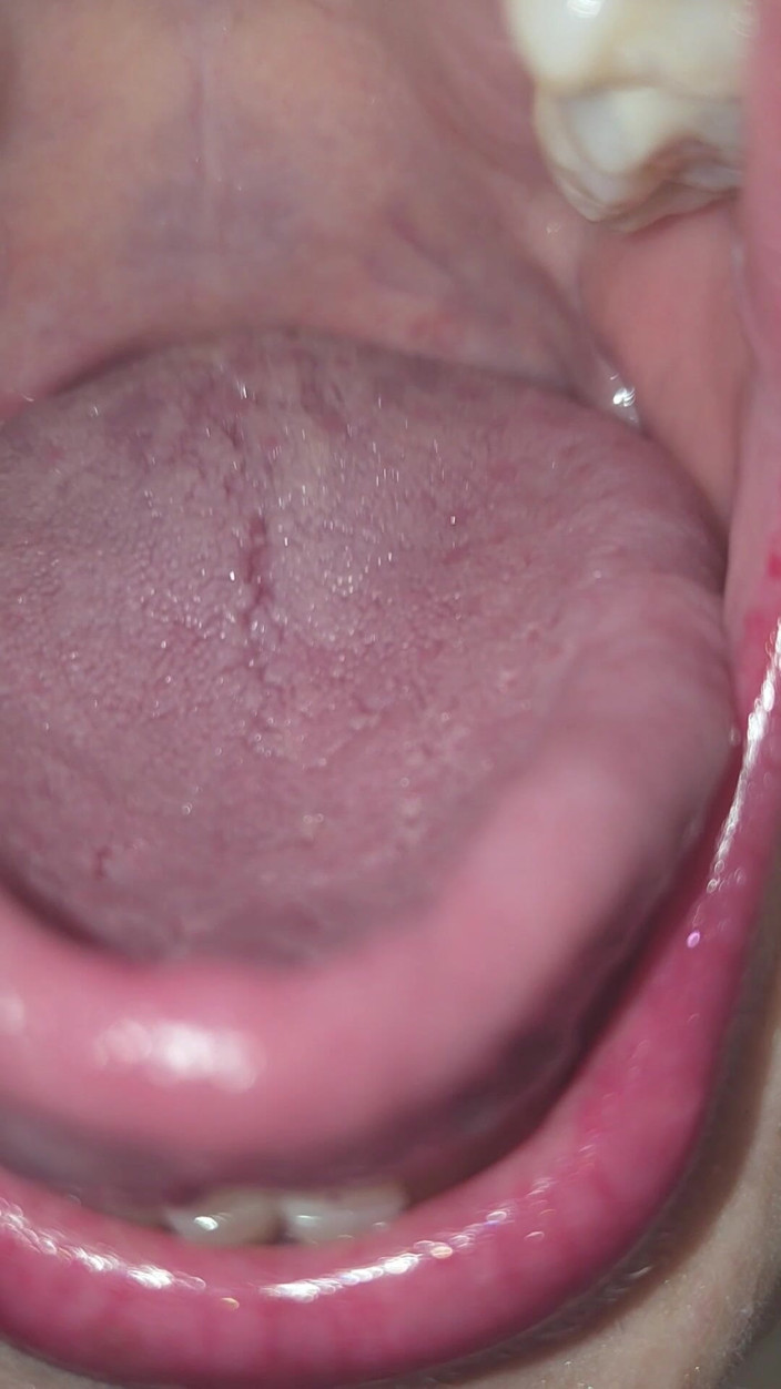 AngYourDirtyCanadian: Uvula retas: Extrem oral närbild