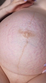 Belly Movements