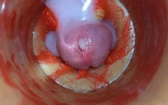 Camera Inside Deep Pussy Captures Very Huge Ejaculation of Sperm Asmr