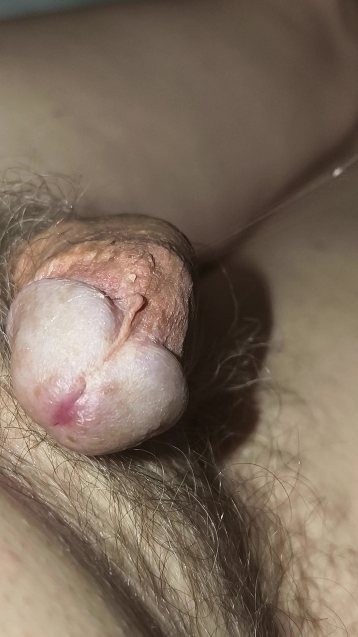 loenne1: Ich Genieße Mein Precum