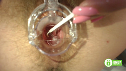 Miodelka: Gyno exam with speculum close up in hairy pussy