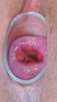I Fuck My Cervix with a Blue Dildo with 3.5 and 4.5 Cm Basin.