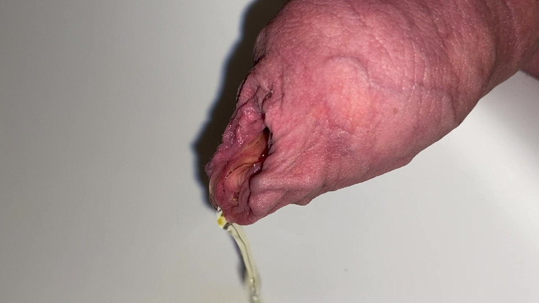 Foreskinguy: Foreskin kencing dan pancutan mani