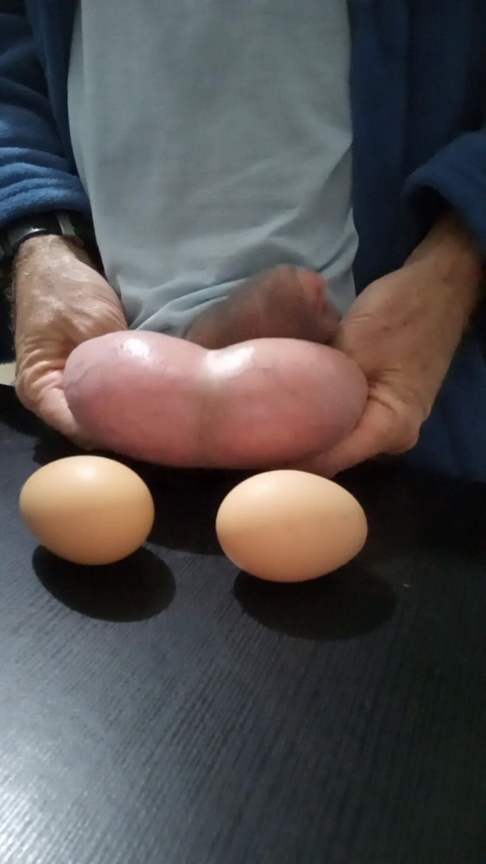 Lion big balls: Measuring and Eggs Comparing