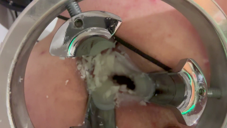 No limit cbt slave: Mencurahkan lilin lilin panas ke dalam keldai