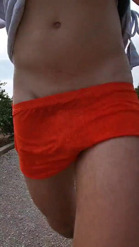 This Is What Happens When I Wear Shorts