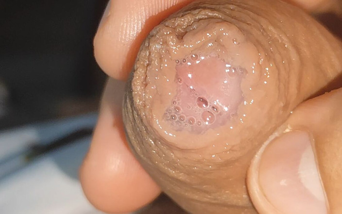Straight Daddy Club: Curious Close-up of Pre-cum in Flaccid Phimosis.