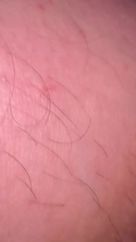 Macro skin no meu pau