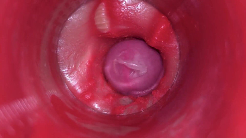 Ladybottox: Cameră în interiorul pizdei: puternic spermă în pizdă! Cel mai bun asmr...