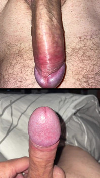 Nudity and Kinkyness