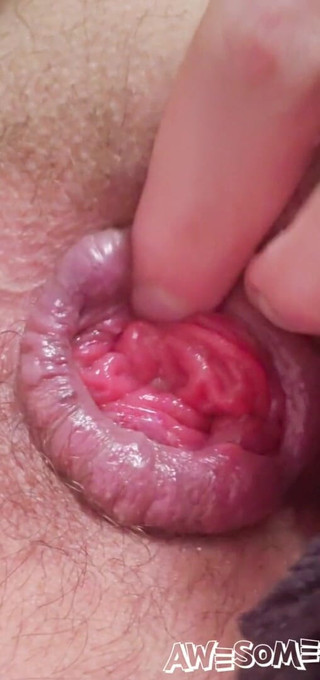 ANTHO St-Armand: Takhle vypadá rosebud