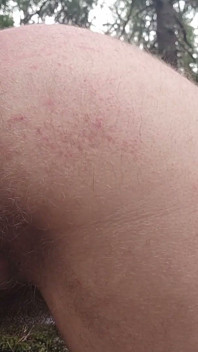 Anal Slut Offers You a Hairy Asshole Outdoors