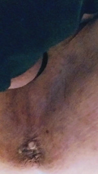 Park and Ride Breeding.