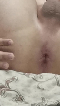 My Ass