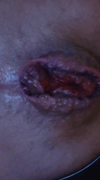 My Hole