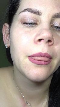 Anna muestra su nariz y estaba atada