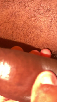 Habesha Dick