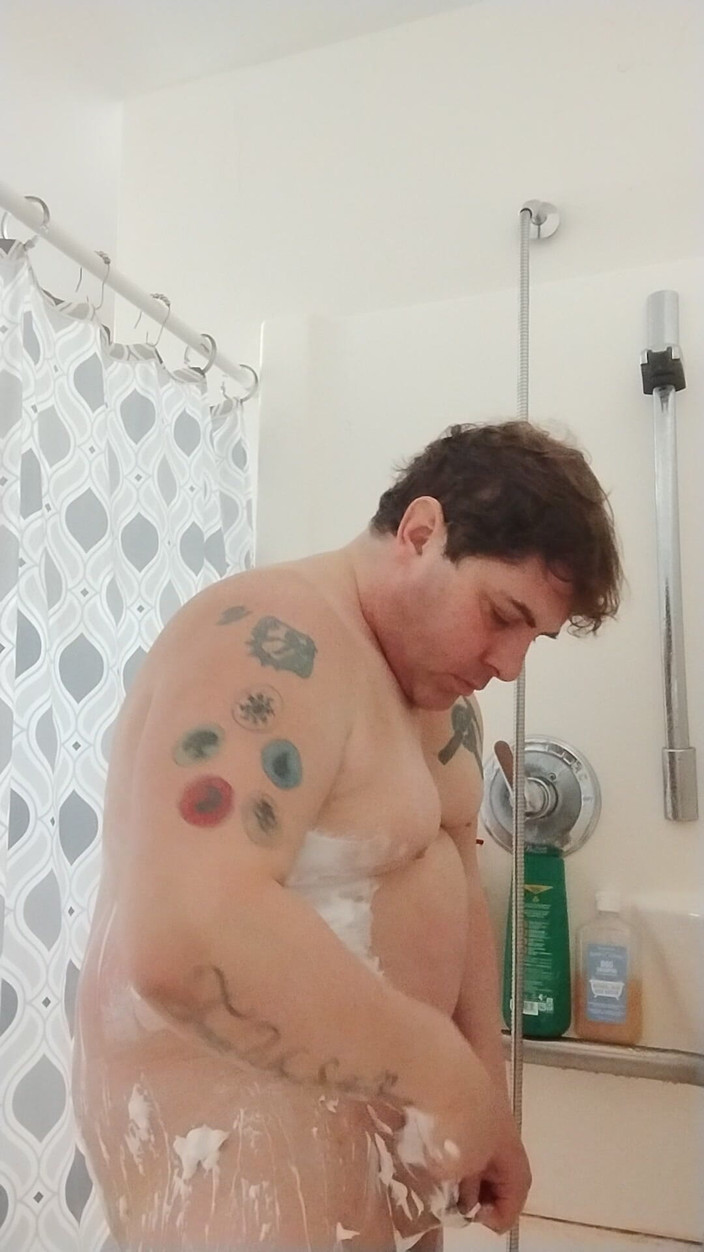 JG Risk: 1-24-2026 Rasage d’une jambe