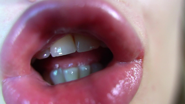 Rarible Diamond: Lippen über dir, brauch