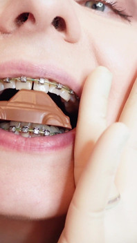 Asmr and Close-ups: Giantess Devour Fetish - Eating Cars From Chocolate. Braces.