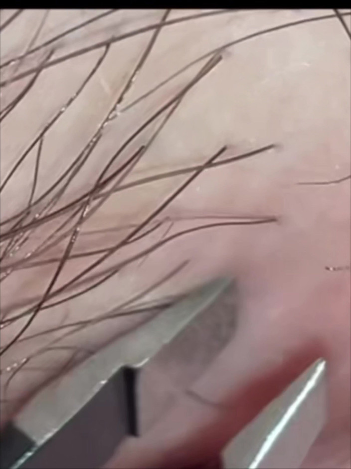 SatisfyingDillyDally: Wskazówki dotyczące szczegółowej gładkości