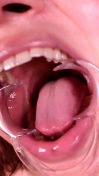 Dentro de mi boca: ginary