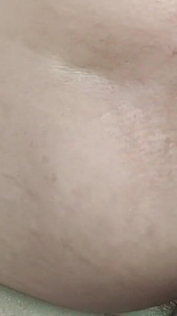 Side Anal