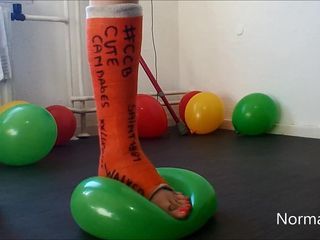 Just Elocin: Estallar globos en una pierna fundida