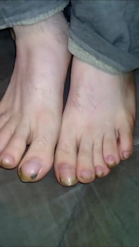 Foot Fancies