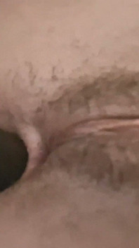 Dilation