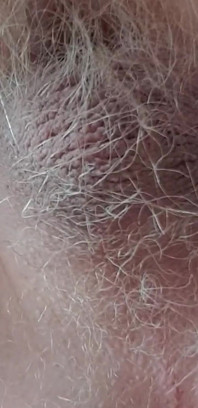 Very Small Cock