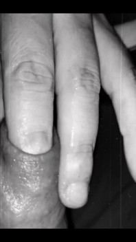 Foreskin Play