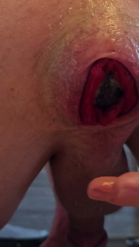 ¡Estiramiento extremo, relleno de huevos de silicona pesada por mi culo y empujar hacia fuera!